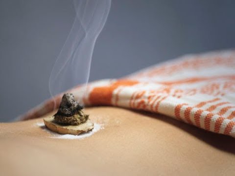 Moxas en Médecine Traditionnelle Asiatique